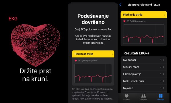 Apple_Watch8_ recenzija_ slika_4_fibrilacija_ atrija